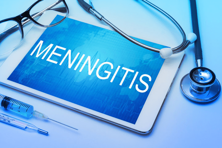 아동 뇌수막염(Meningitis) 문헌고찰